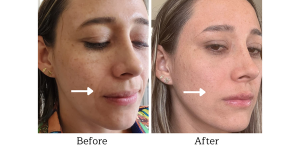 Instant Facelift Cream