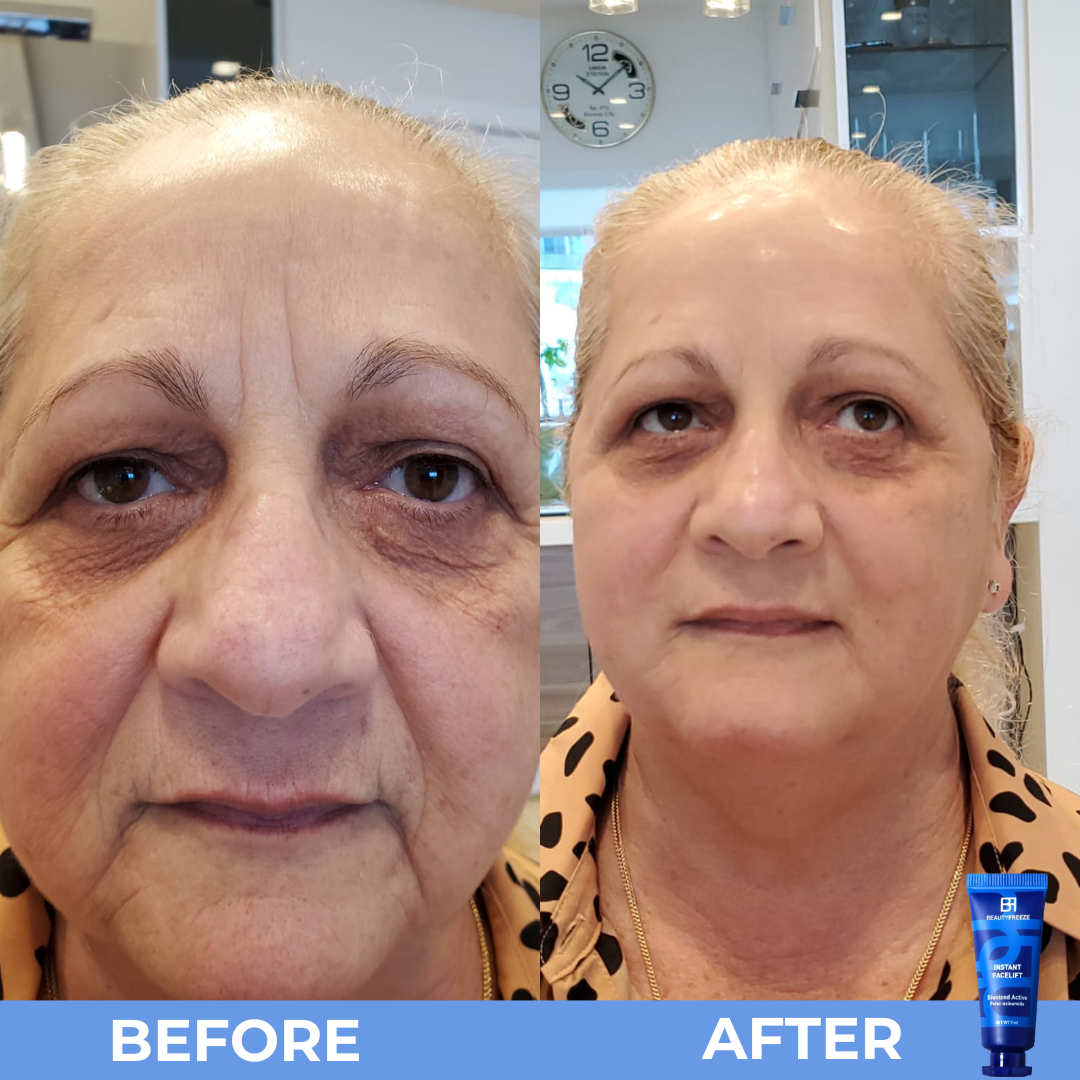 Before and After