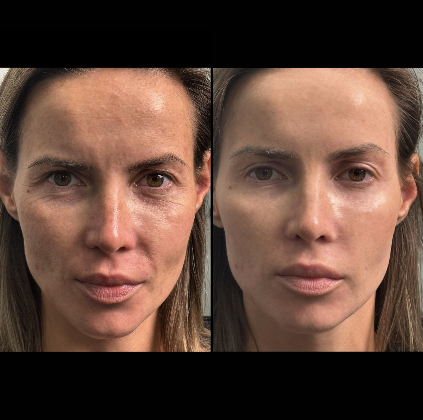 Instant Facelift Cream