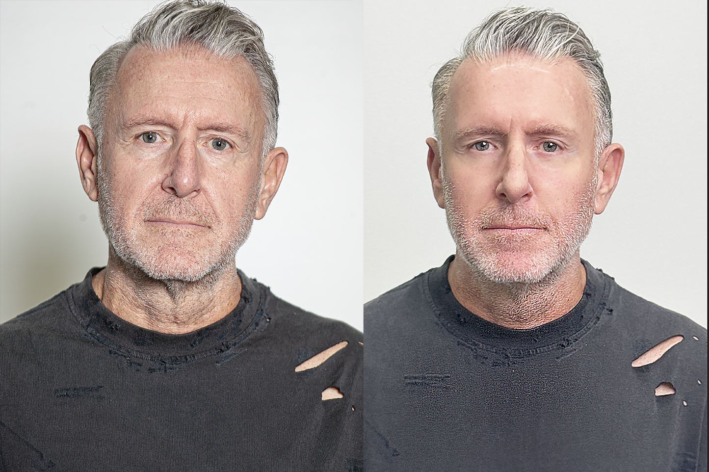 Instant Facelift Cream