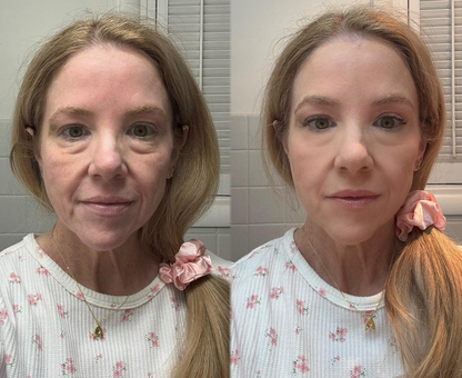 Instant Facelift Cream