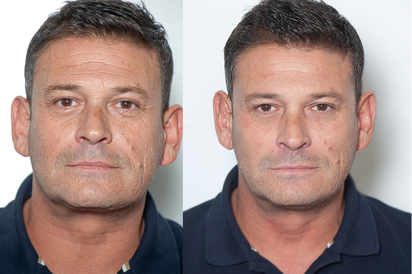 Instant Facelift Cream