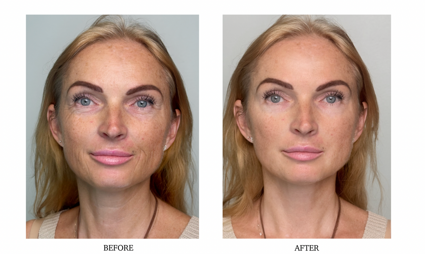 Instant Facelift Cream