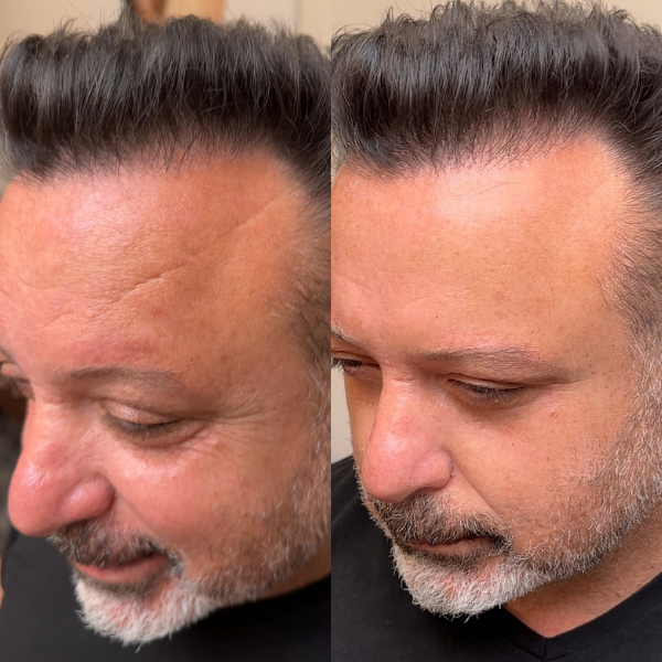 Instant Facelift Cream