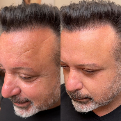 Instant Facelift Cream