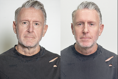 Instant Facelift Cream