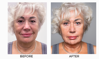Instant Facelift Cream